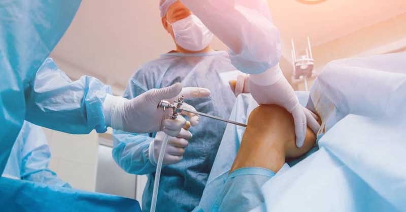 Knee Shoulder Arthroscopy Surgeon